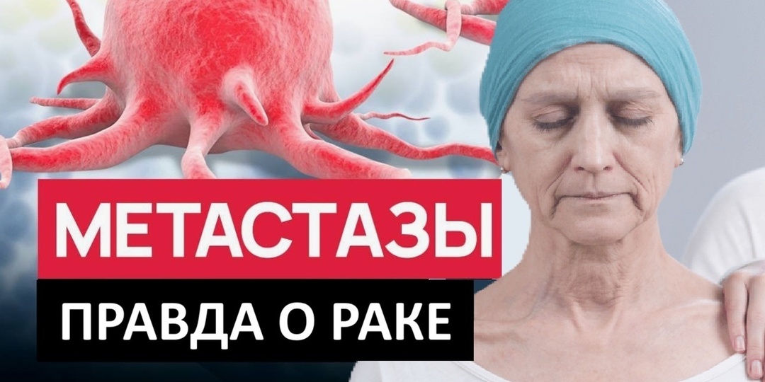 Главный секрет метастазов: почему даже при IV стадии есть шанс - и как им воспользоваться