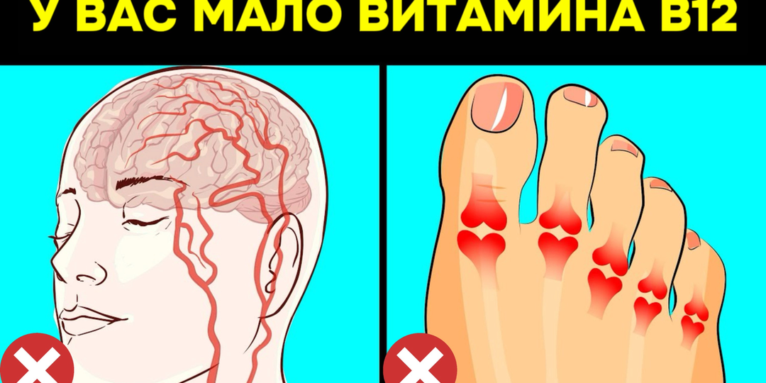 10 критических признаков дефицита Витамина В12, которые мы никогда не должны игнорировать