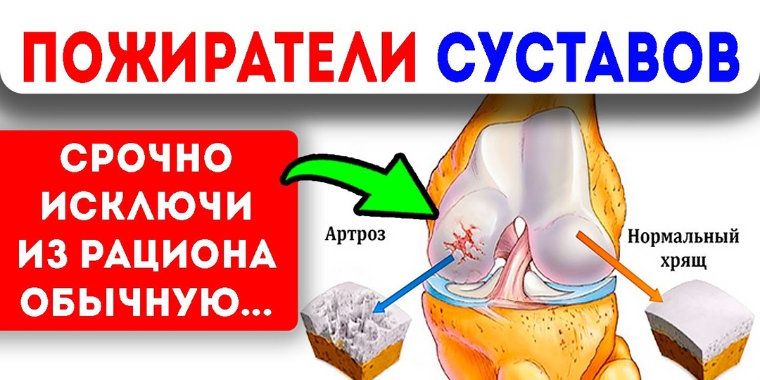 От каких продуктов лучше отказаться, если у вас Болят Суставы