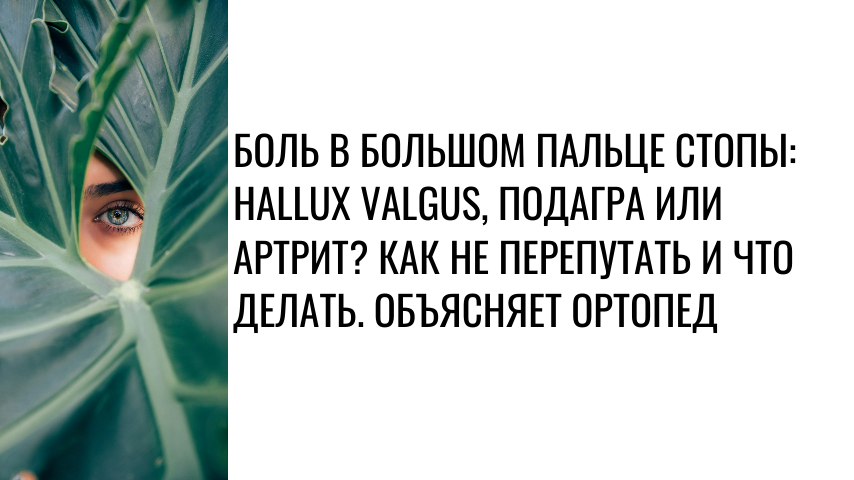 Боль в большом пальце стопы: hallux valgus, подагра или артрит? Как не перепутать и что делать