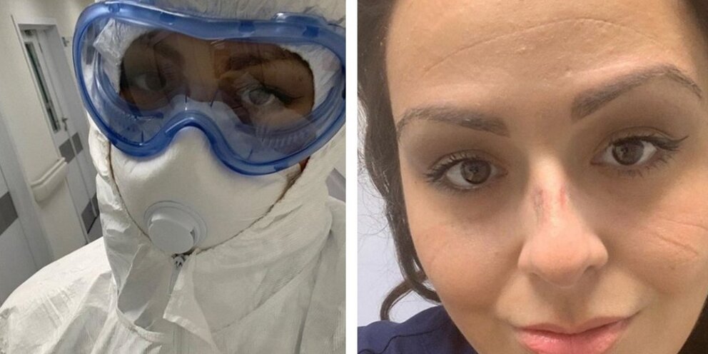 Источник: врачи "Коммунарки" сегодня попробуют вывести Костомарова из медикамент