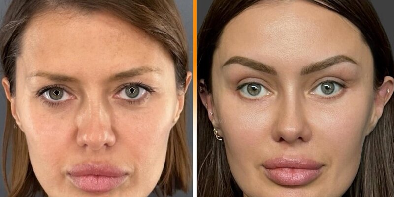 замуж за пластического хирурга