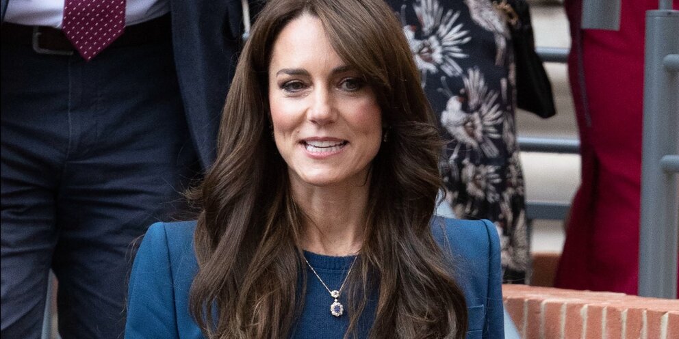 Фото миддлтон после операции. Фото миддлтон после операции. Кейт миддлтон рот. Кейт миддлтон виниры. Кейт миддлтон до пластики.