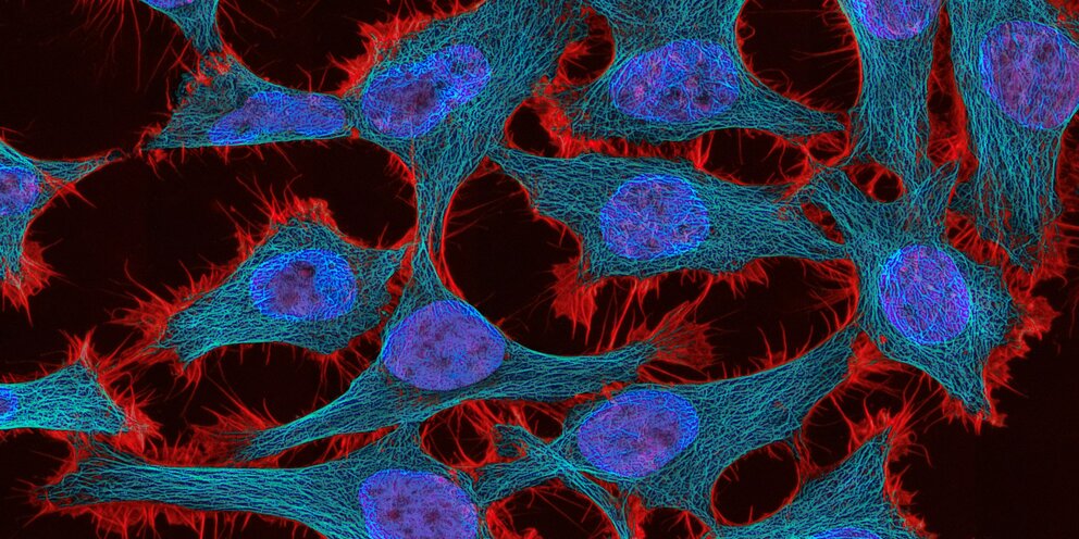 Цитологическим признаком пви. Дегенеративно измененные клетки. Реактивно измененный эпителий в цитологии что. Реактивное воспаление цитология. Клетки с дегенеративными изменениями.