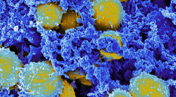 стафилококк чувствительность к антибиотикам. стафилококк коагулазоположительные (s. среда обитания стафилококка. стафилококк пройдет сам пройдет. стафилококк ауреус на жса.