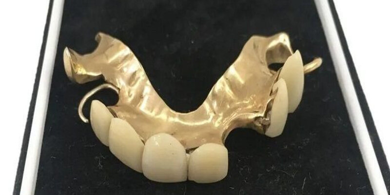 Литье зубных протезов. Каркас бюгельного протеза. Коронка 46. Литье зубных протезов. Коронка цельнолитая (сплав remanium).