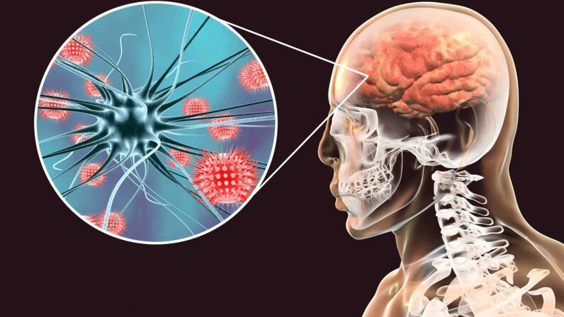 Мигрень у женщин. Уменьшение боли. Изображение головной боли. Слабость и головокружение. У человека болит голова.