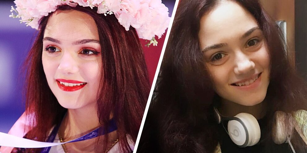 Загитова до и после пластики Как выглядят Загитова, Медведева и другие суперзвезды фигурки без макияжа. Мы на