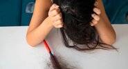 Ученые нашли новое средство от&nbsp;облысения|