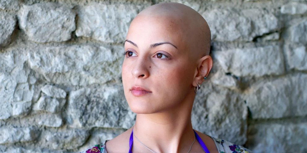 Рост волос после химиотерапии