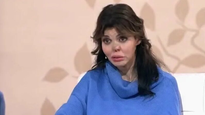 Казьмина алиса фото после пластики