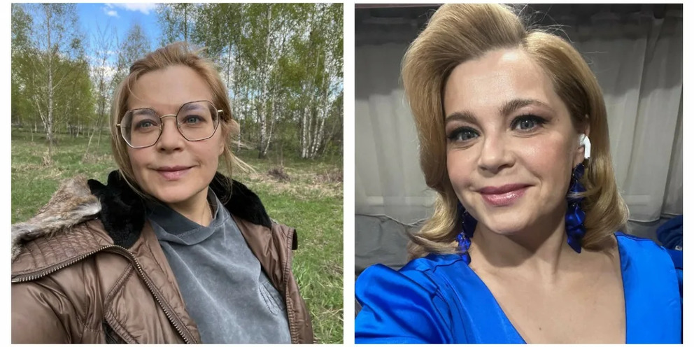 Пегова после пластики фото
