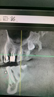 Байки стоматолога