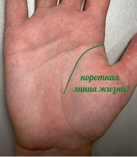 Короткая линия жизни?