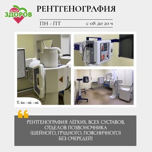 Рентгенография
