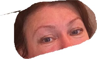 практики на верхнюю треть лица