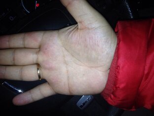 Линия симиан