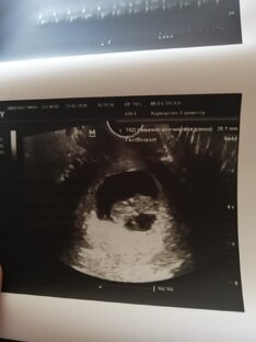 История родов📝