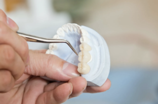 Всё про коронки