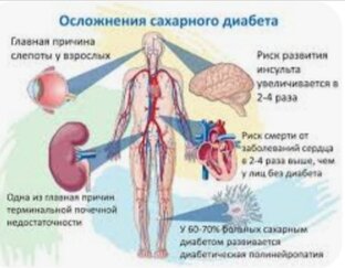 Осложнения сахарного диабета