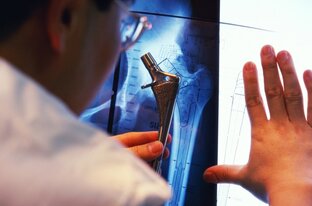 Опорно-двигательный аппарат 🦴