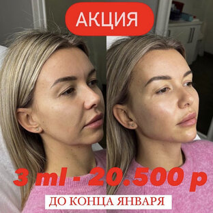 Нижняя треть 