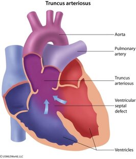 Сердечно-Сосудистая Система