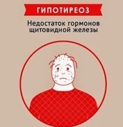 Гипотиреоз и АИТ