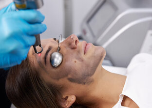  Spectra Peel 