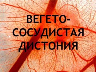 ВСД (вегето-сосудистая дистония)