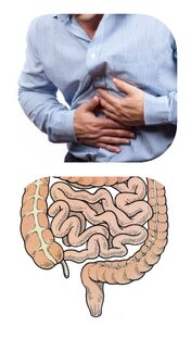 Дисбактериоз излечим.