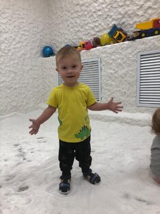 Синдром Дауна