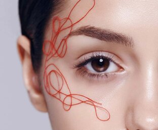 Купероз и розацеа