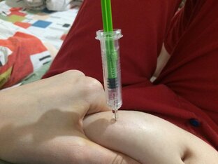 Невынашивание и замершие беременности