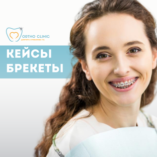 КЕЙСЫ и рабочие процессы