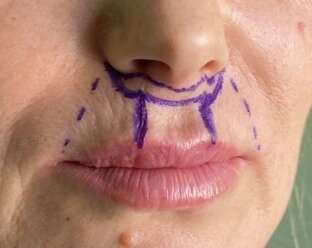 Фото с описанием 