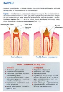 Кариес.Причины.Последствия