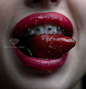 Статистика Дзен Стоматология Smile Gallery