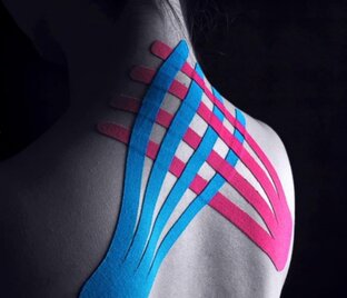 Тейпирование