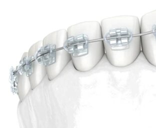 Ортодонтия