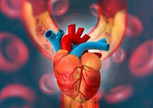 Атеросклероз и все-все-все