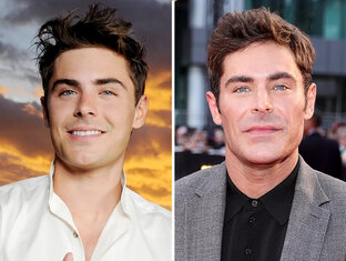 Звезды и пластика: зачем?