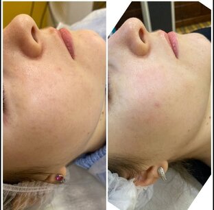 РЕЗУЛЬТАТЫ ДО И ПОСЛЕ 