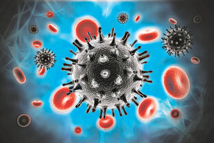 Все об Инфекциях