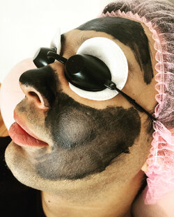 Карбоновый пилинг