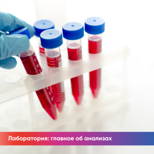 Лаборатория: главное об анализах крови