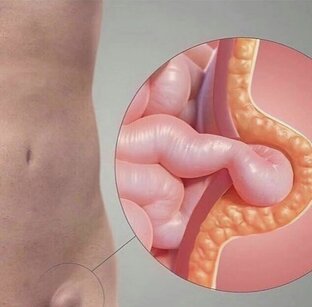 Просто о заболеваниях