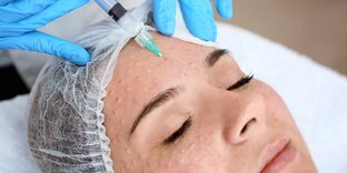 Биоревитализация