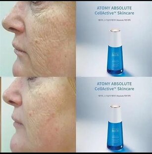 Уход за кожей