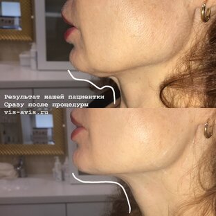 Результаты